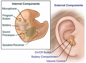 Parts of a Hearing Aid